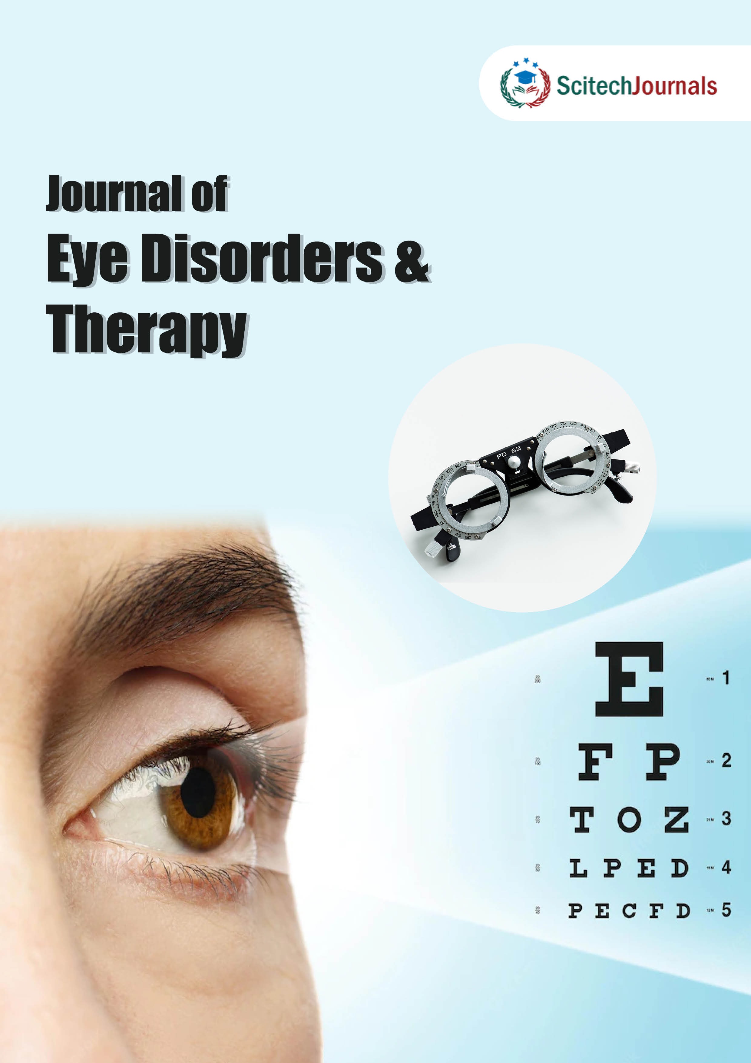 Journal of Eye Disorders and Therapy Journal of Eye Disorders and Therapy
