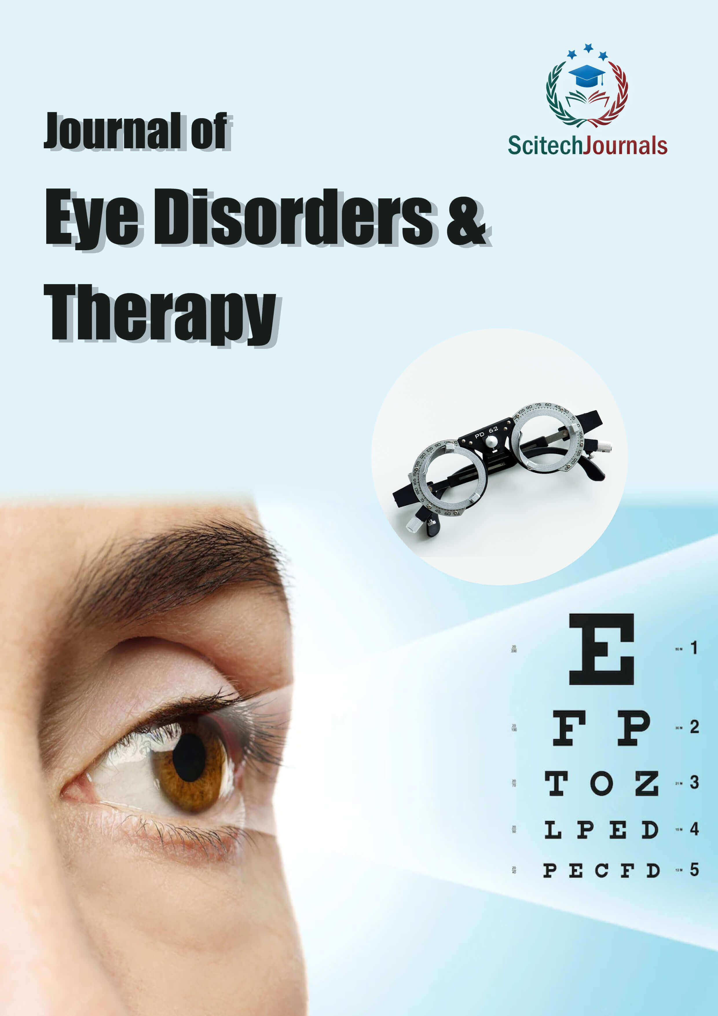 Journal of Eye Disorders & Therapy