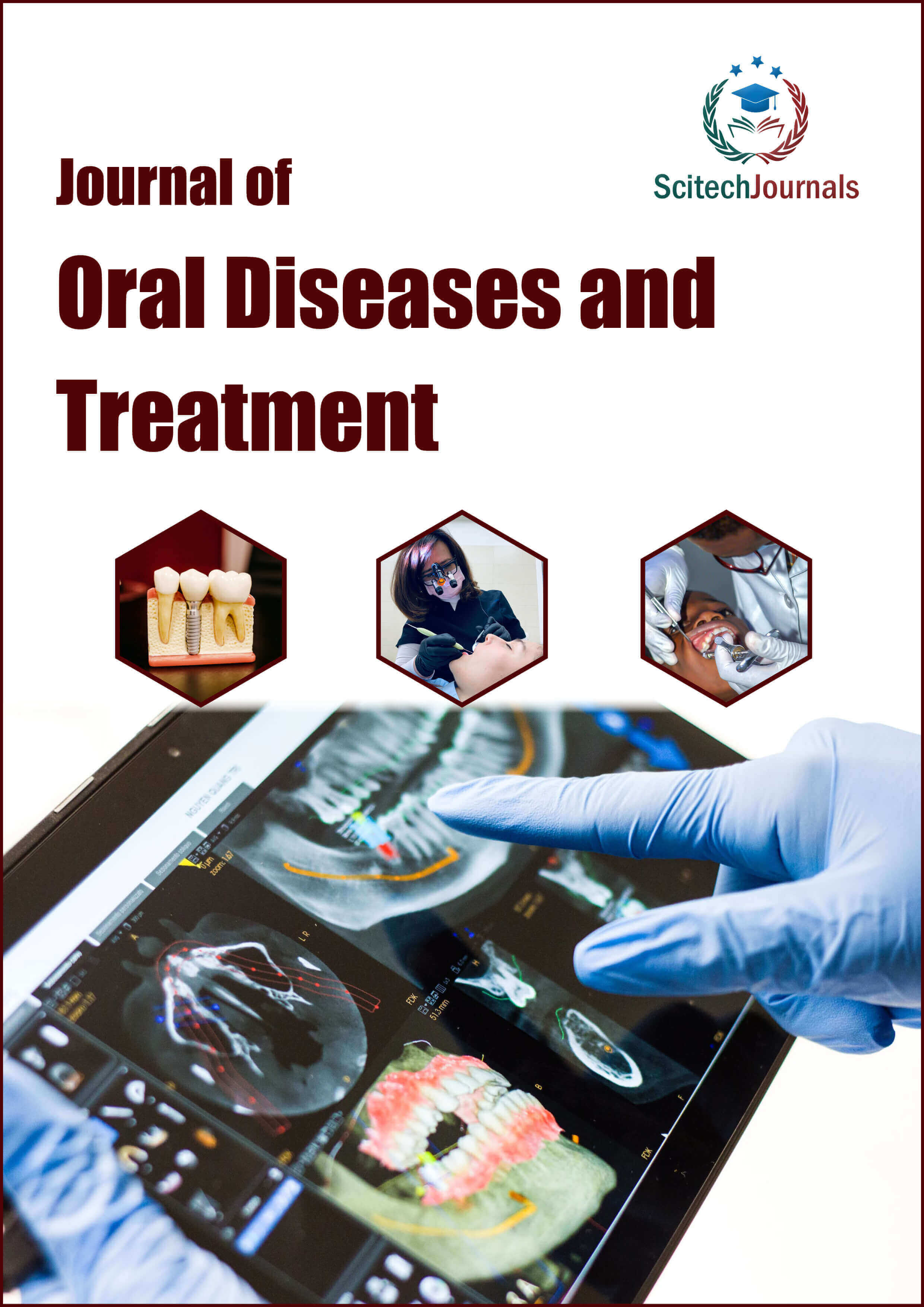 Journal of Oral Diseases and Treatment