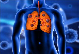 2nd World Congress on COPD and Pulmonary Diseases